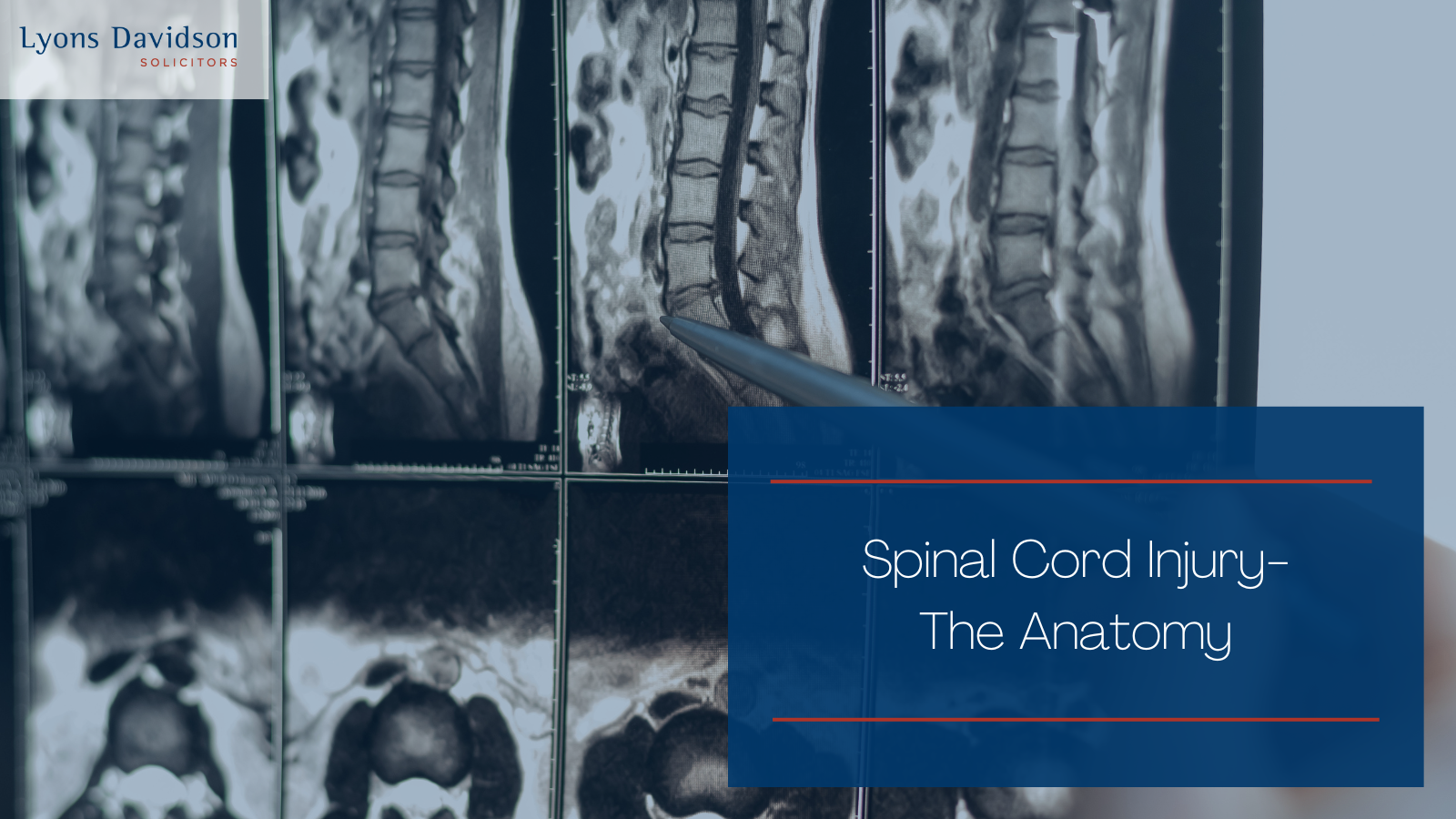 Spinal Cord Injury- The Anatomy - Lyons Davidson Solicitors